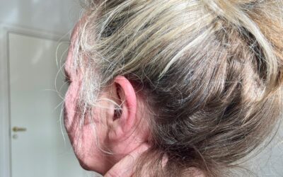 Mange med hodepine overser dette: nakken kan være årsaken